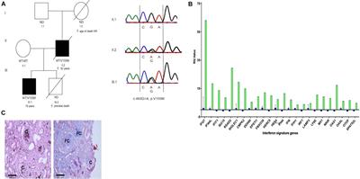 Microbiology Spectrum Impact Factor
